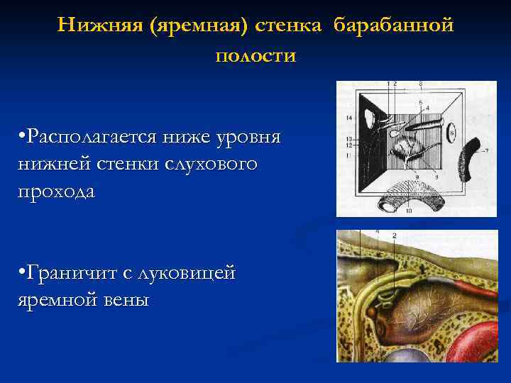 Нижняя (яремная) стенка барабанной полости • Располагается ниже уровня нижней стенки слухового прохода •