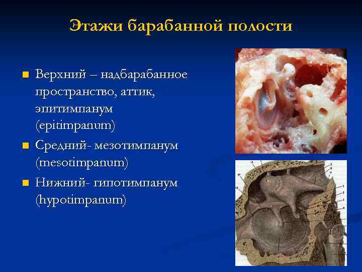 Этажи барабанной полости n n n Верхний – надбарабанное пространство, аттик, эпитимпанум (epitimpanum) Средний-