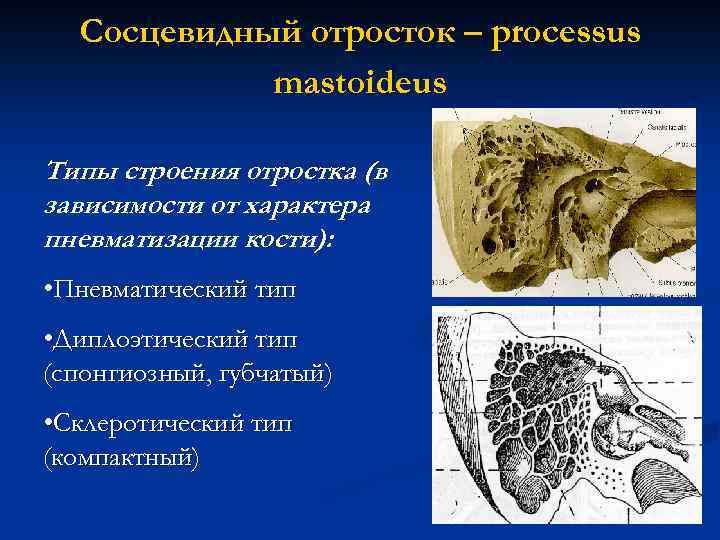 Сосцевидный отросток – processus mastoideus Типы строения отростка (в зависимости от характера пневматизации кости):