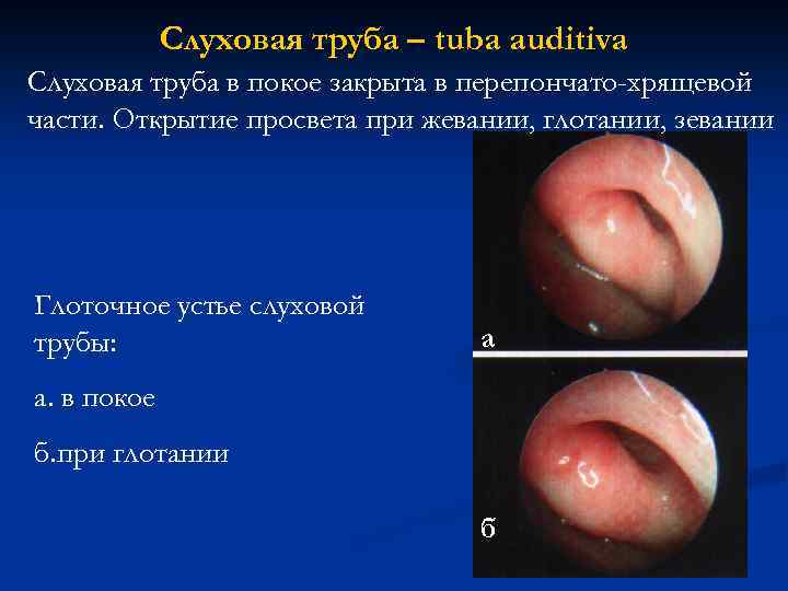 Слуховая труба – tuba auditiva Слуховая труба в покое закрыта в перепончато-хрящевой части. Открытие