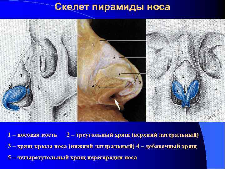 Пазухи носа анатомия фото