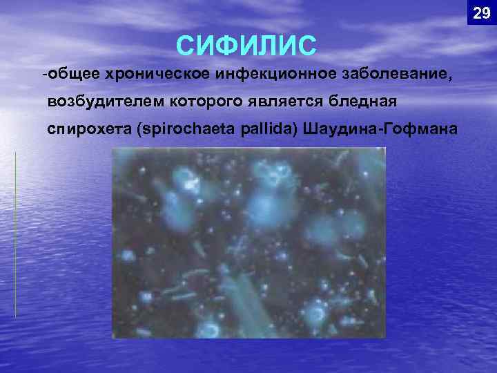 29 СИФИЛИС -общее хроническое инфекционное заболевание, возбудителем которого является бледная спирохета (spirochaeta pallida) Шаудина-Гофмана