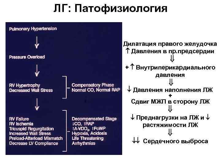 ЛГ: Патофизиология Дилатация правого желудочка Давления в пр. предсердии + Внутриперикардиального давления Давления наполнения