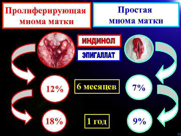 Простая миома матки Пролиферирующая миома матки 12% 6 месяцев 7% 18% 1 год 9%