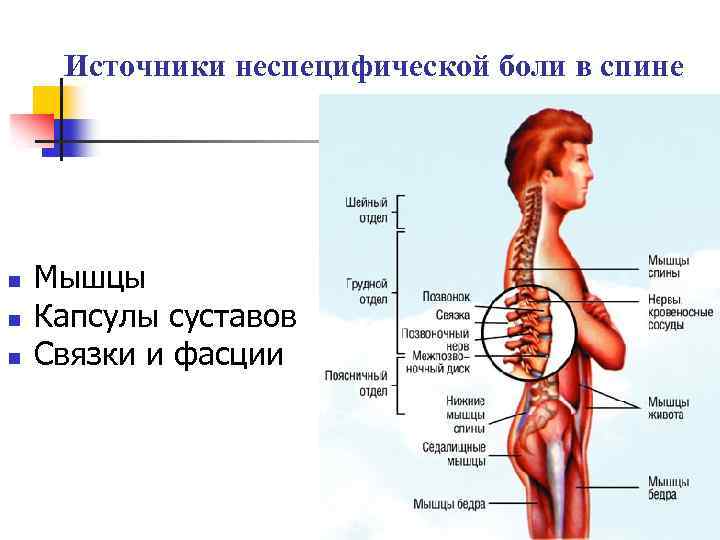 Источники неспецифической боли в спине n n n Мышцы Капсулы суставов Связки и фасции