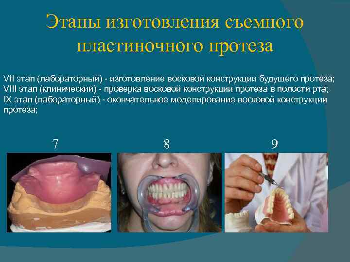 Клинико лабораторные этапы изготовления бюгельных протезов презентация