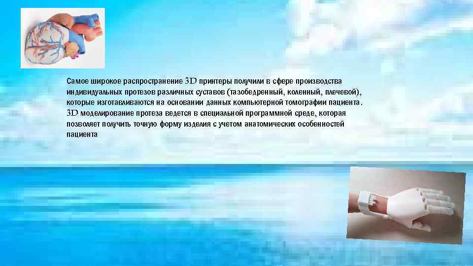 Самое широкое распространение 3 D принтеры получили в сфере производства индивидуальных протезов различных суставов