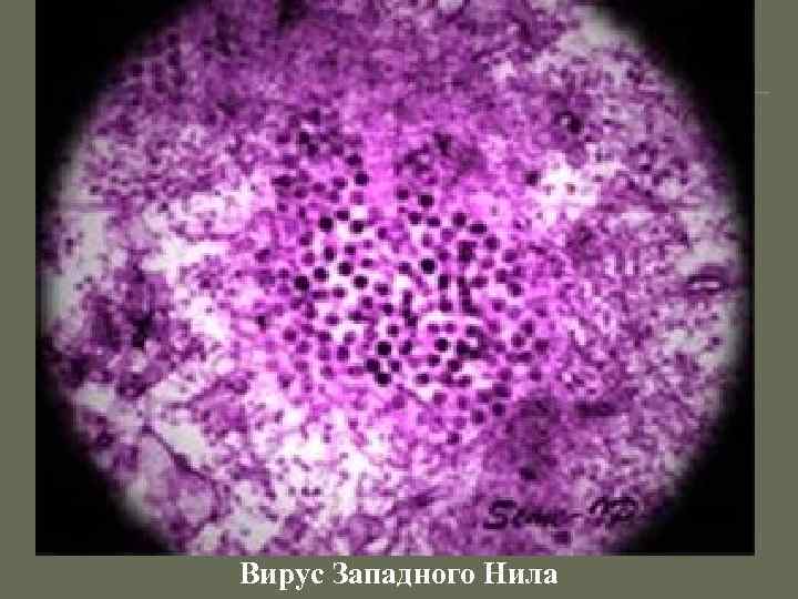 Вирус Западного Нила 