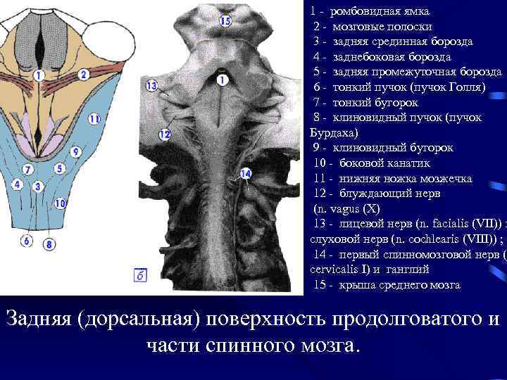 1 - ромбовидная ямка 2 - мозговые полоски 3 - задняя срединная борозда 4