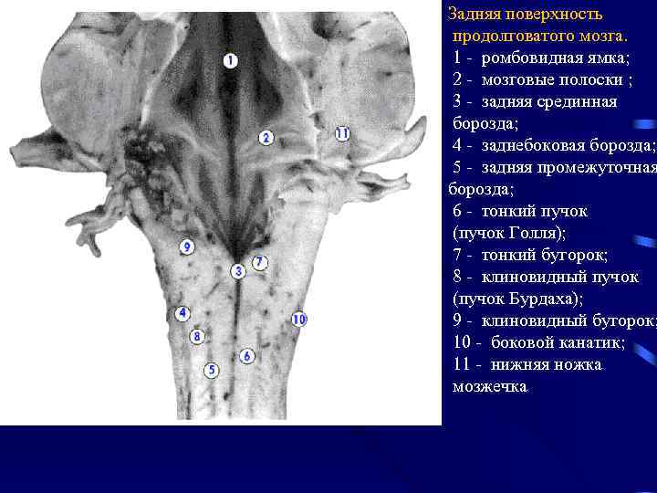 Задняя поверхность продолговатого мозга. 1 - ромбовидная ямка; 2 - мозговые полоски ; 3