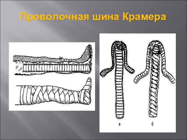 Проволочная шина Крамера 