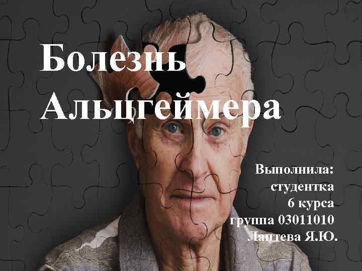 Болезнь Альцгеймера Выполнила: . студентка 6 курса группа 03011010 Лаптева Я. Ю. 