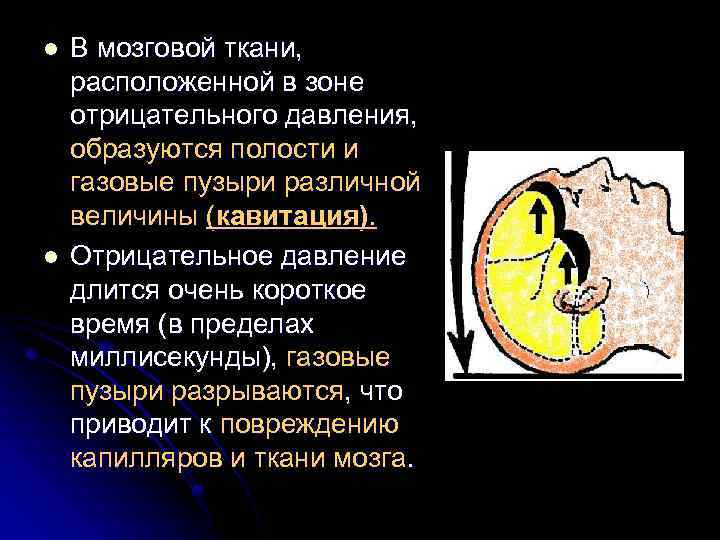 l l В мозговой ткани, расположенной в зоне отрицательного давления, образуются полости и газовые