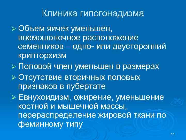 Клиника гипогонадизма Ø Объем яичек уменьшен, внемошоночное расположение семенников – одно- или двусторонний крипторхизм