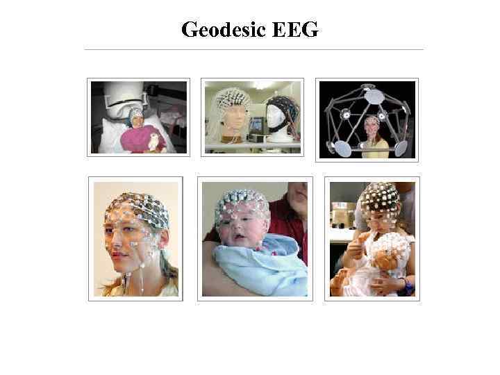 Geodesic EEG 