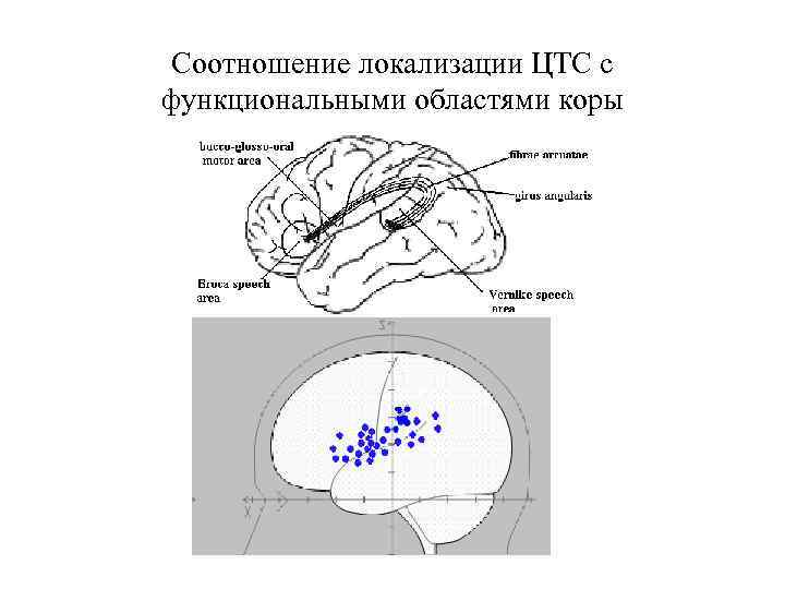 Соотношение локализации ЦТС с функциональными областями коры 