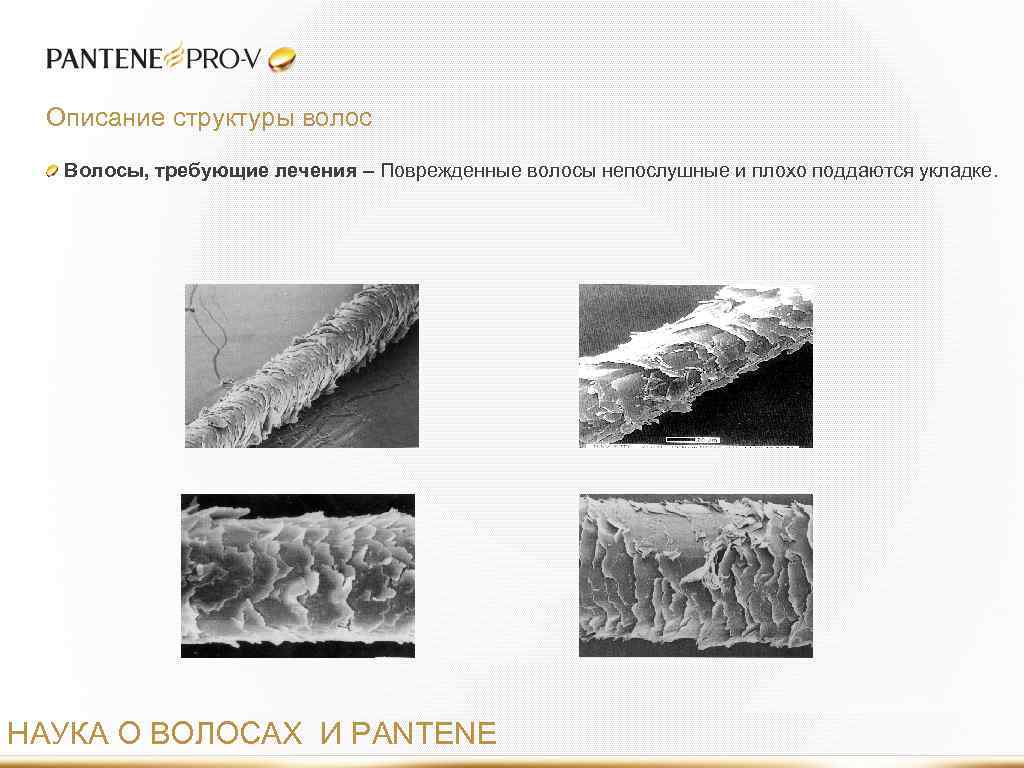 Описание структуры волос Волосы, требующие лечения – Поврежденные волосы непослушные и плохо поддаются укладке.