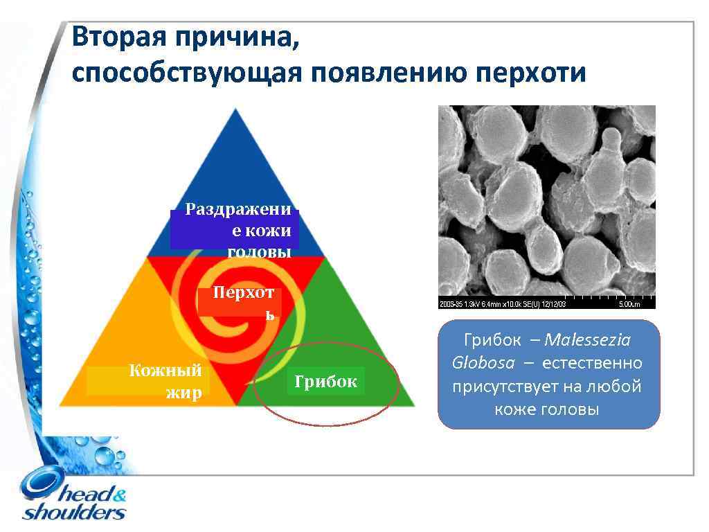 Вторая причина, способствующая появлению перхоти Раздражени е кожи головы Перхот ь Кожный жир Грибок