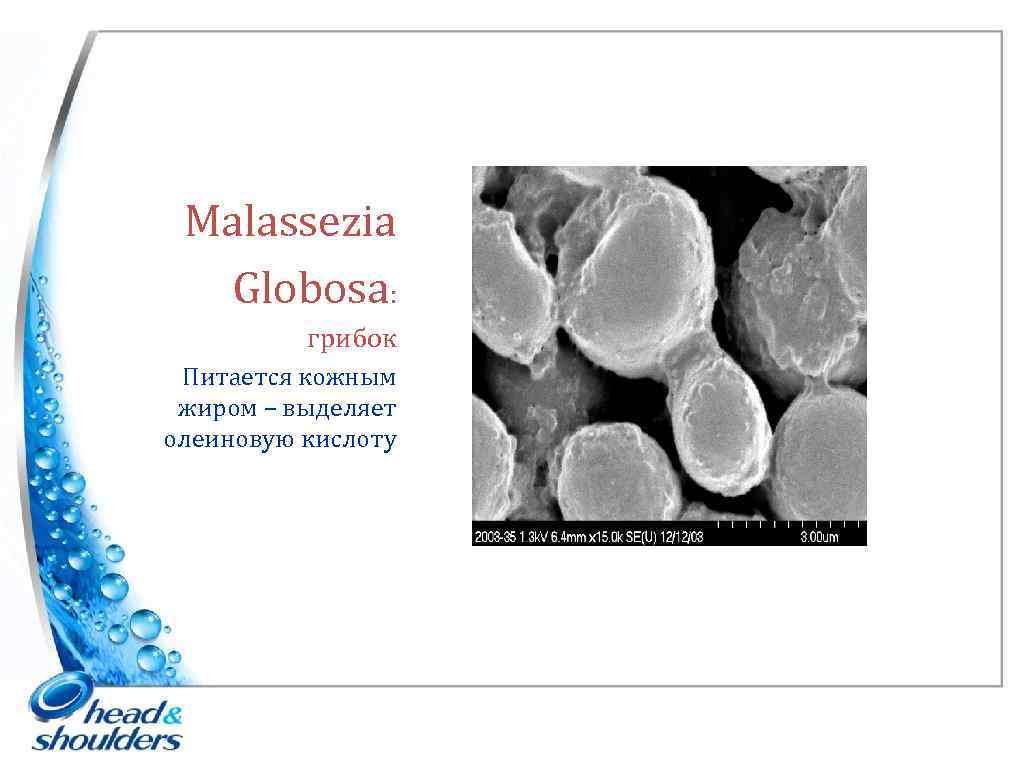 Malassezia Globosa: грибок Питается кожным жиром – выделяет олеиновую кислоту 