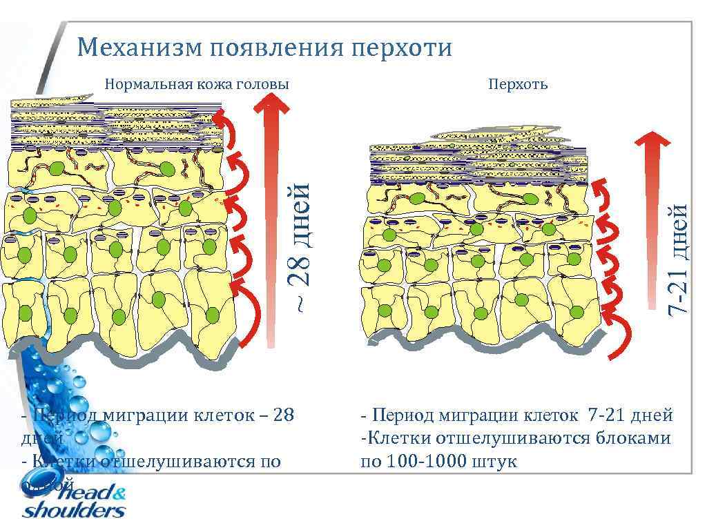 Механизм появления перхоти - Период миграции клеток – 28 дней - Клетки отшелушиваются по