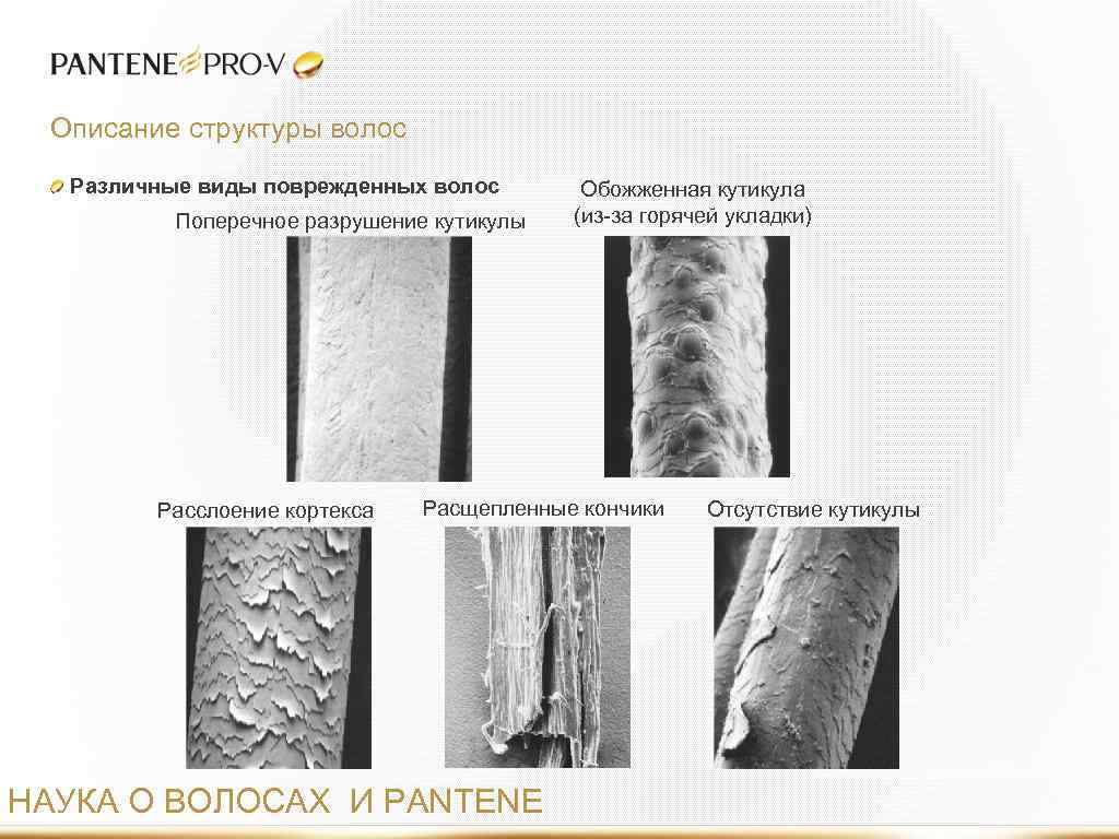 Описание структуры волос Различные виды поврежденных волос Поперечное разрушение кутикулы Расслоение кортекса Обожженная кутикула