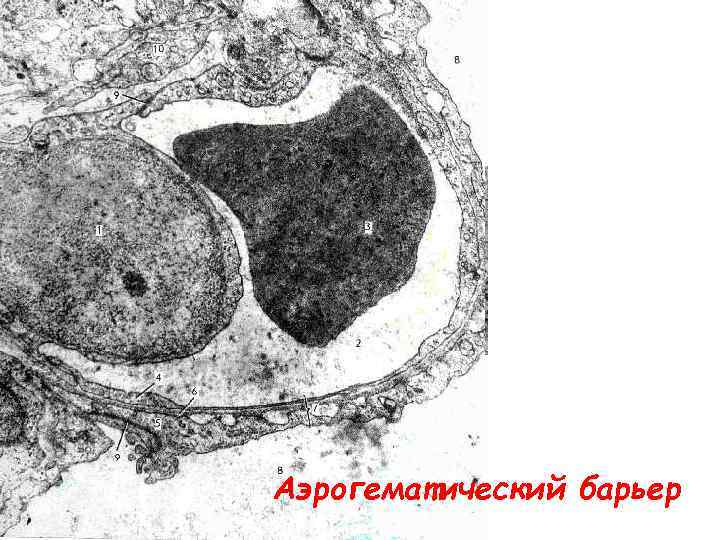 Аэрогематический барьер презентация