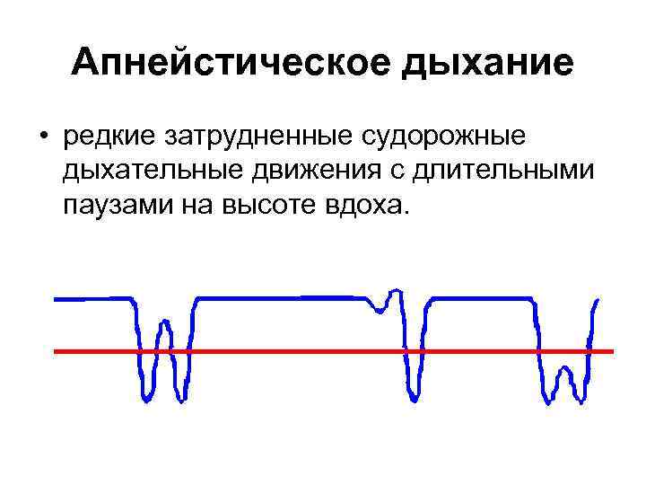 Патологическое дыхание рисунок