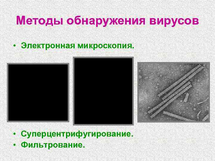 Методы обнаружения вирусов • Электронная микроскопия. • Суперцентрифугирование. • Фильтрование. 