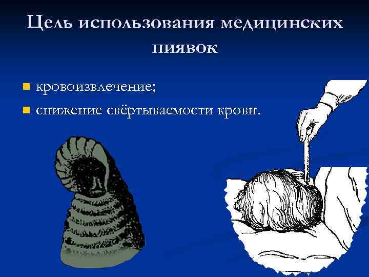 Цель использования медицинских пиявок кровоизвлечение; n снижение свёртываемости крови. n 