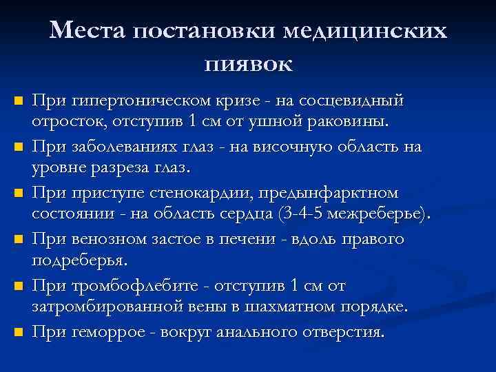 Места постановки