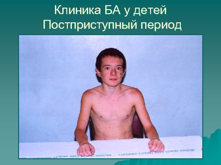 Клиника БА у детей Постприступный период 