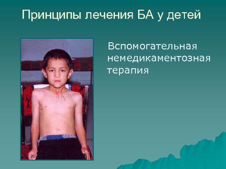 Принципы лечения БА у детей Вспомогательная немедикаментозная терапия 