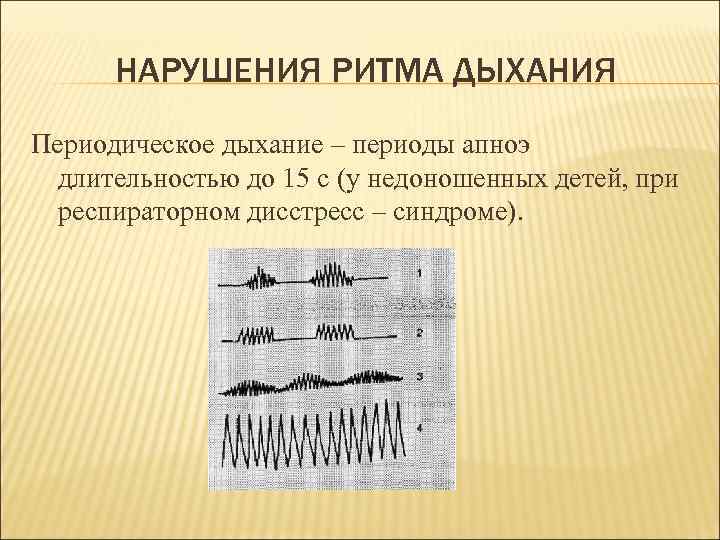 Периоды дыхания. Нарушение ритма дыхания. Нарушения ритма и глубины дыхания. Формы нарушения ритма дыхания. Тип и ритм дыхания.