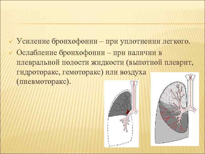 Гидроторакс карта вызова