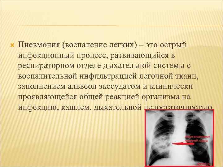  Пневмония (воспаление легких) – это острый инфекционный процесс, развивающийся в респираторном отделе дыхательной