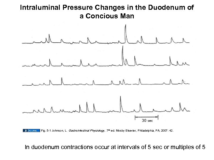 Intraluminal Pressure Changes in the Duodenum of a Concious Man Fig. 5 -1 Johnson,