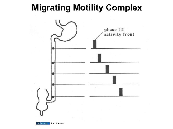 Migrating Motility Complex Jim Sherman 