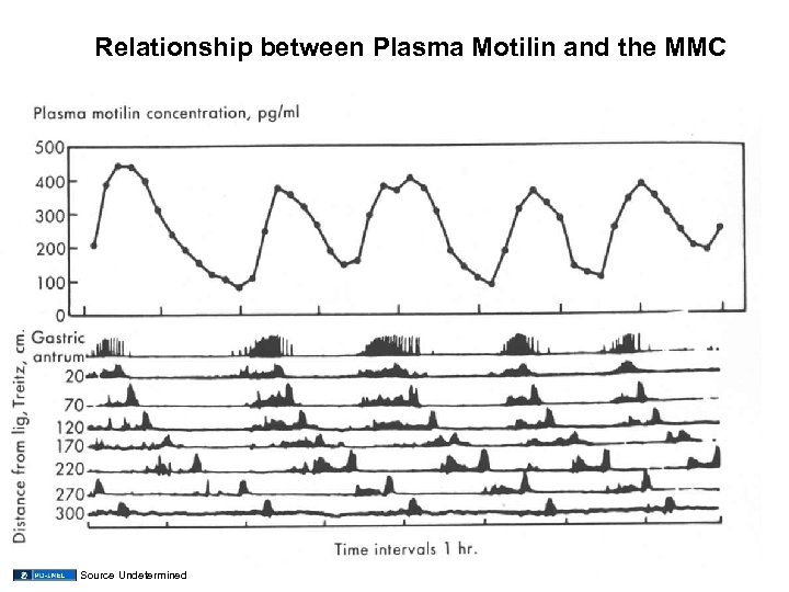 Relationship between Plasma Motilin and the MMC Source Undetermined 