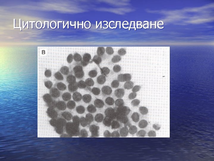 Цитологично изследване 