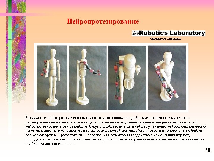 Нейропротезирование University of Washington В созданных нейропротезах использовано текущее понимание действия человеческих мускулов и