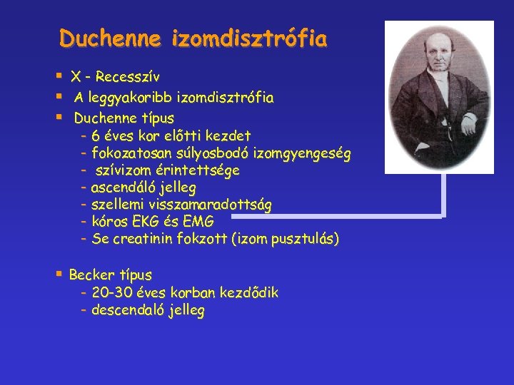 Duchenne izomdisztrófia § § § X - Recesszív A leggyakoribb izomdisztrófia Duchenne típus -