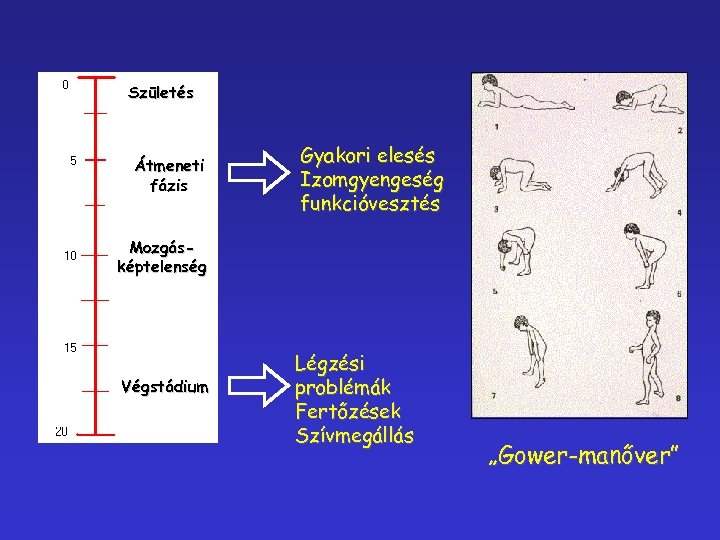 Születés Átmeneti fázis Gyakori elesés Izomgyengeség funkcióvesztés Mozgásképtelenség Végstádium Légzési problémák Fertőzések Szívmegállás „Gower-manőver”