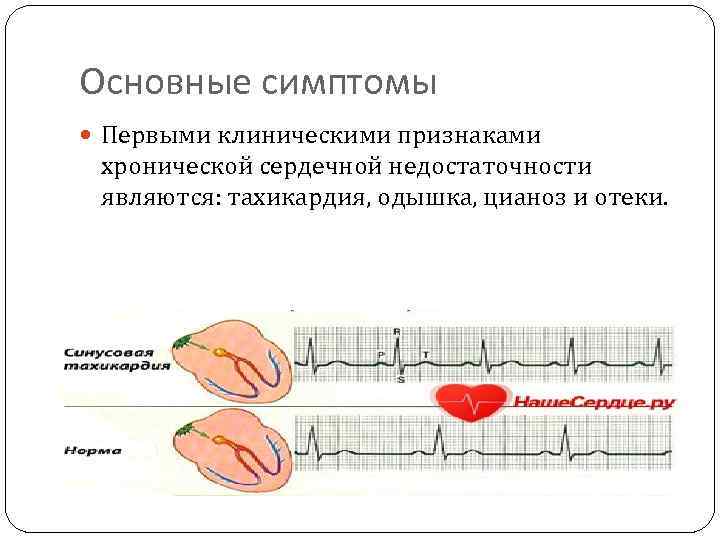 Основные симптомы Первыми клиническими признаками хронической сердечной недостаточности являются: тахикардия, одышка, цианоз и отеки.