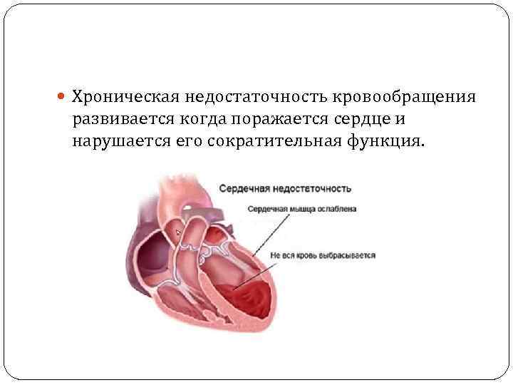  Хроническая недостаточность кровообращения развивается когда поражается сердце и нарушается его сократительная функция. 