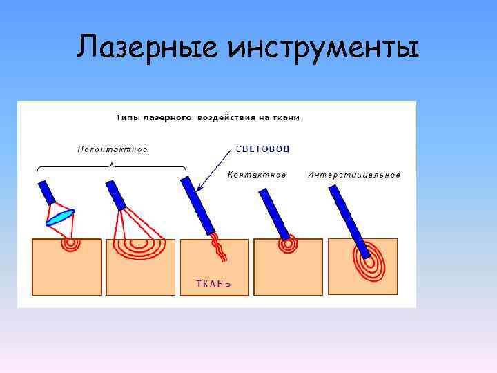 Лазерные инструменты 