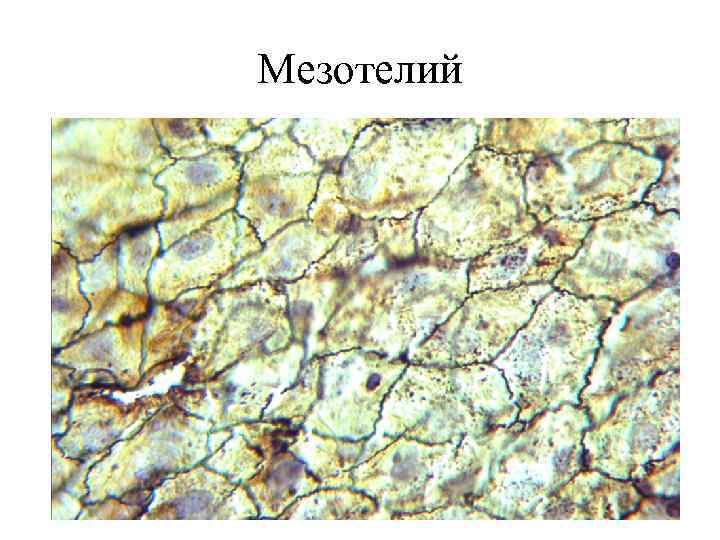 Мезотелий 