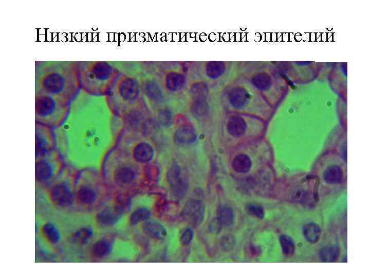 Низкий призматический эпителий 