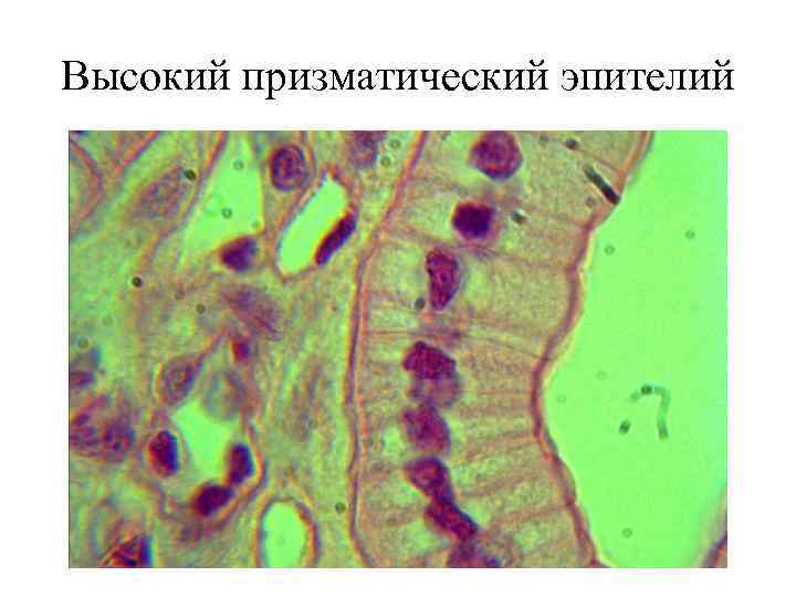 Высокий призматический эпителий 