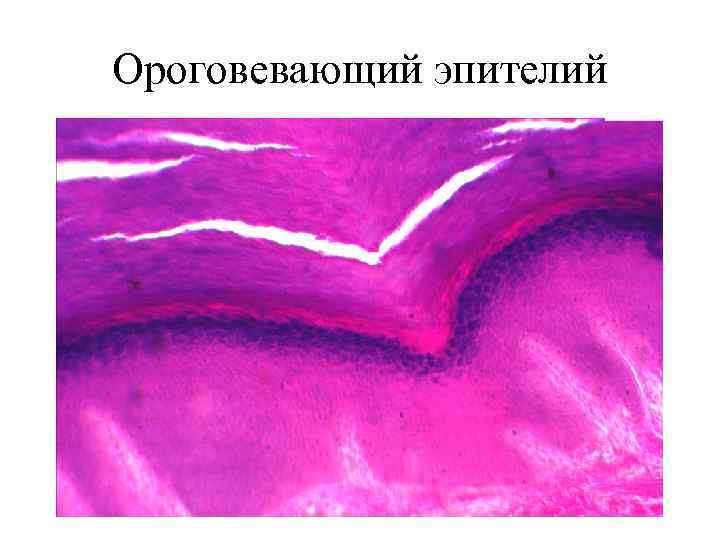 Ороговевающий эпителий 