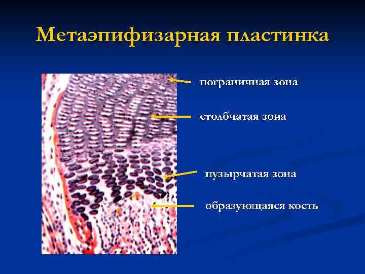 Метаэпифизарная пластинка пограничная зона столбчатая зона пузырчатая зона образующаяся кость 